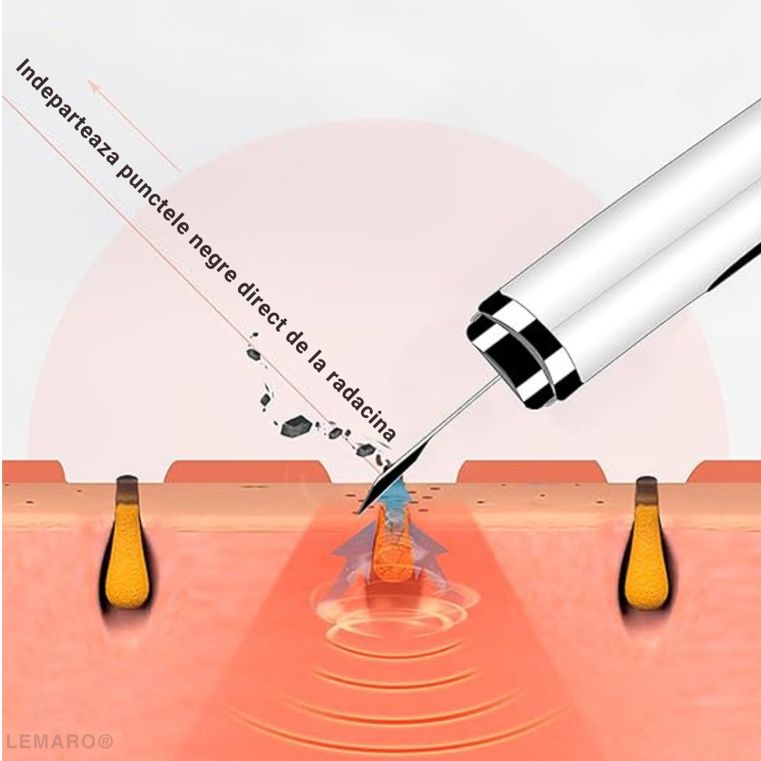 Aparat pentru Curatare Faciala cu Ultrasunete, Lifting Ten, cu Ioni, Skin Scrubber