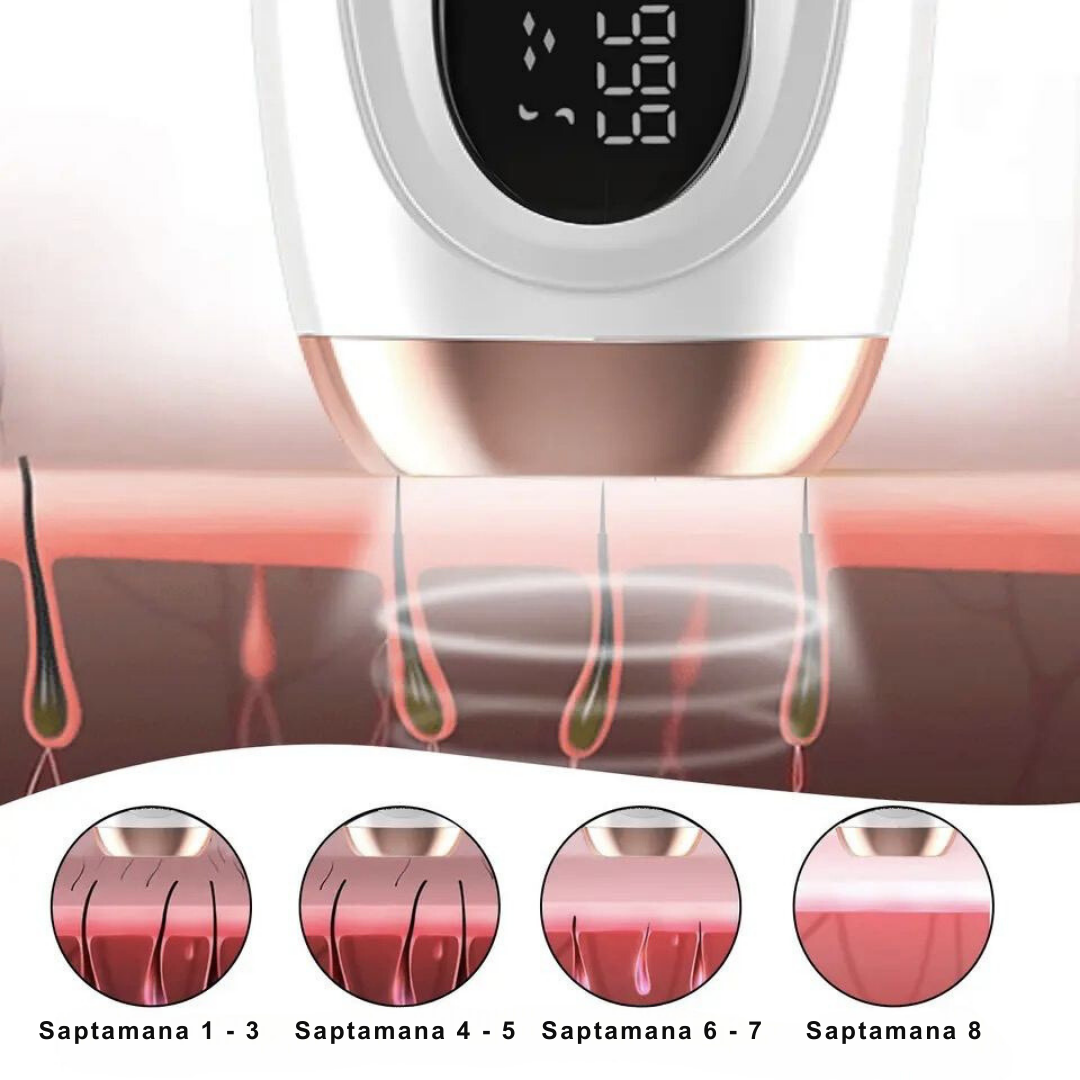 Epilator IPL, R1, 999.999 Pulsatii, Pentru Epilare Definitiva Fara Durere, 5 Trepte De Intensitate