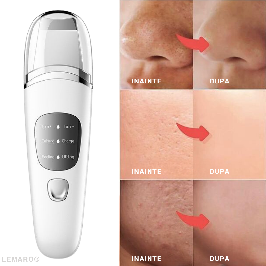 Aparat pentru Curatare Faciala cu Ultrasunete, Lifting Ten, cu Ioni, Skin Scrubber